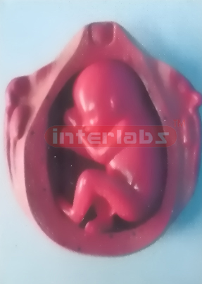 UTERUS WITH EMBRYO (7 MONTH)